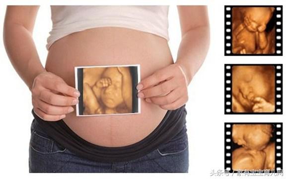 过期妊娠孕妈该怎么办,什么是过期妊娠