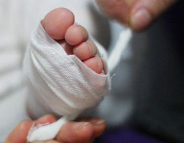 哺乳期风热感冒的治疗方法,哺乳期风热感冒怎么办最有效