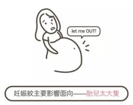 抹预防妊娠纹的精油手法,妊娠纹预防油推荐