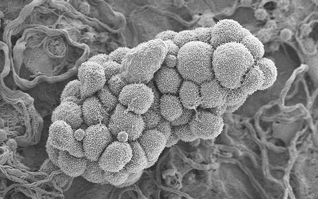 有痛经症状却无月经来是什么原因,妇科经期前量少痛经