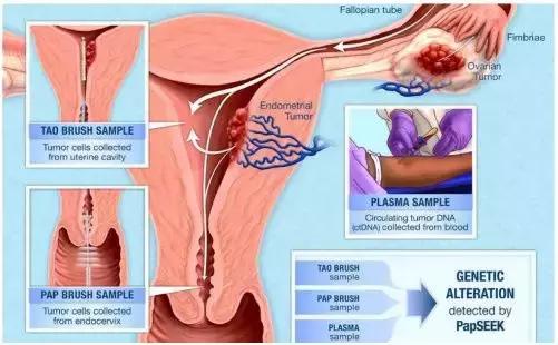 抗癌新突破最新消息,抗癌最新突破新药