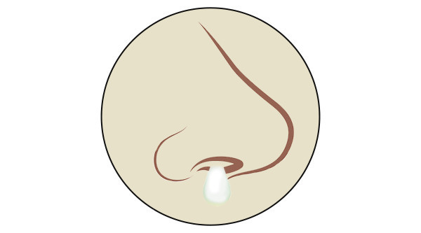 流不同颜色的鼻涕代表什么,鼻子有浓稠黄鼻涕是什么原因