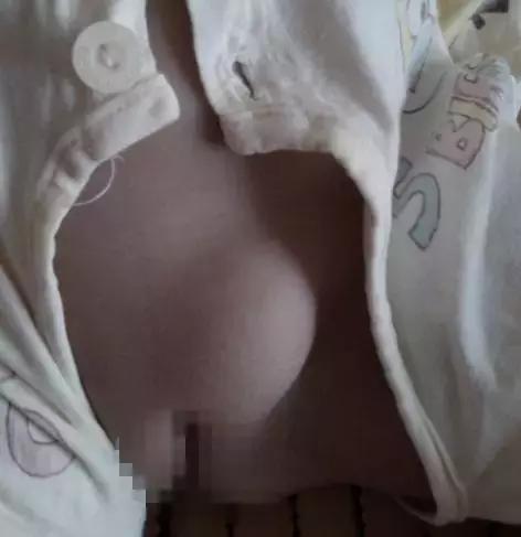 双排牙预防方法,预防孩子双排牙有什么方法