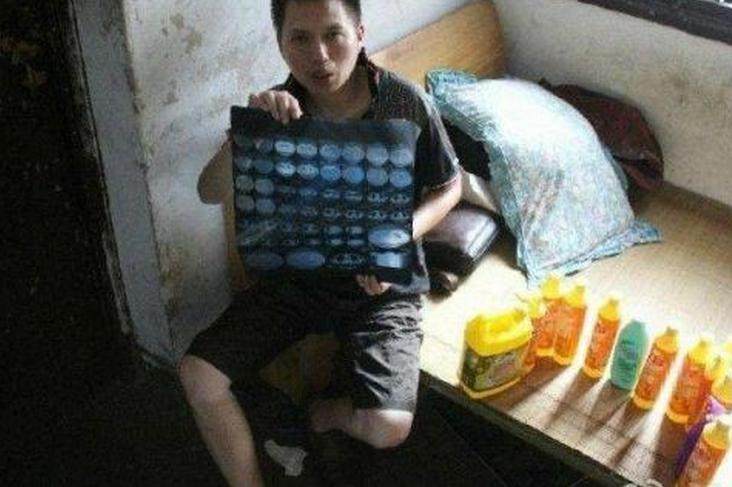 男子把饮料当水喝结果身体不适,男子喝洗洁精