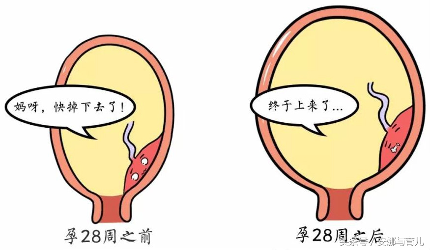 边缘性前置胎盘产检内容,产检查出唐氏儿怎么办