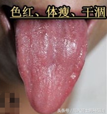 辨清“肾虚”,让大家明明白白“补肾”