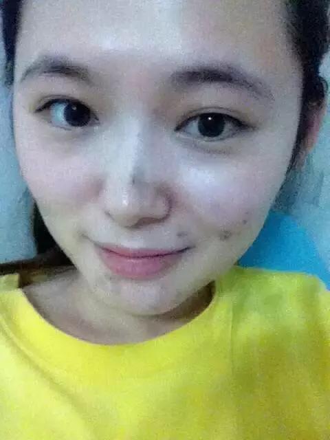 祛痘什么产品最有效的,最有效的祛痘产品推荐一下