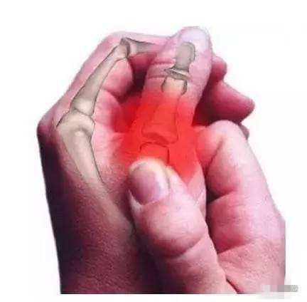 每天握鼠标手疼怎么办呢,鼠标手小臂酸痛怎么缓解