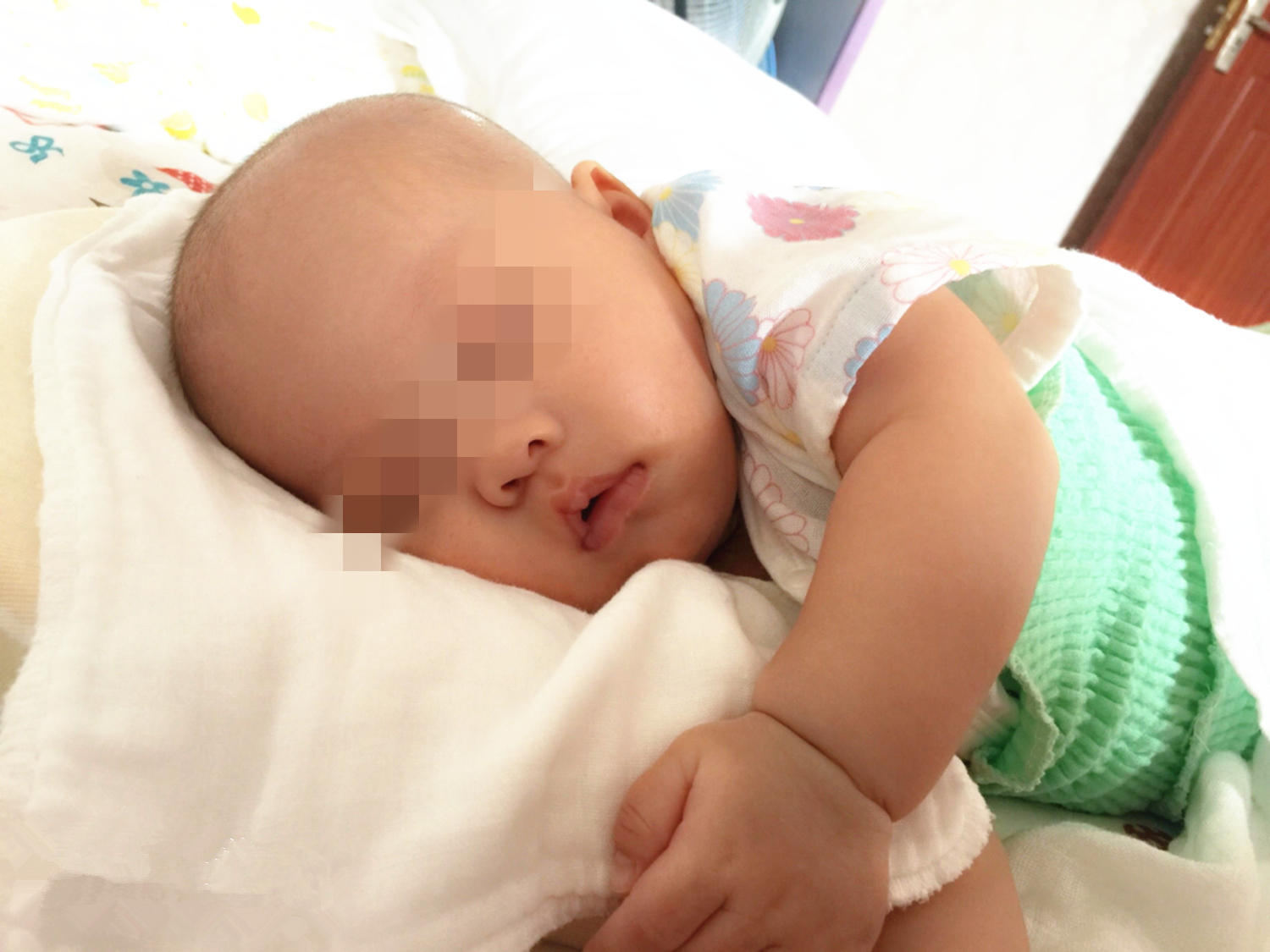 小孩总是红屁股怎么办,宝宝总是红屁股到底怎么治疗呢