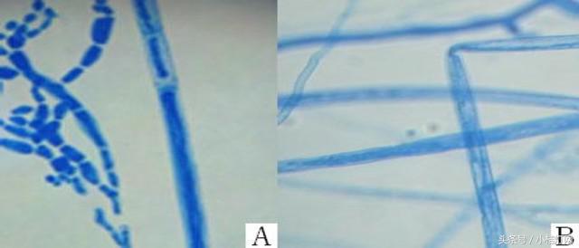 真菌微生物国标检测方法,微生物真菌检验