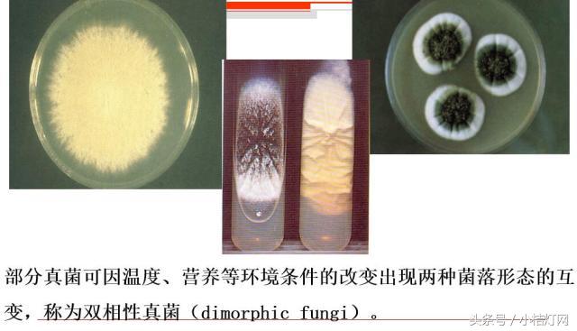 ivd基础知识大全,真菌检测要点