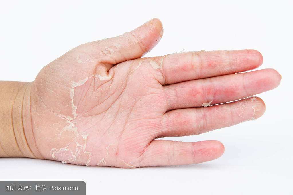 梁医生讲皮肤瘙痒怎么办,医生分享皮肤痒都用什么药抹