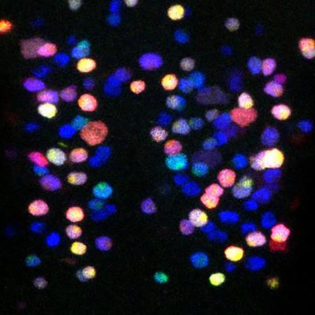 科学家诱导出人类全能干细胞,干细胞治疗脑损伤有效吗