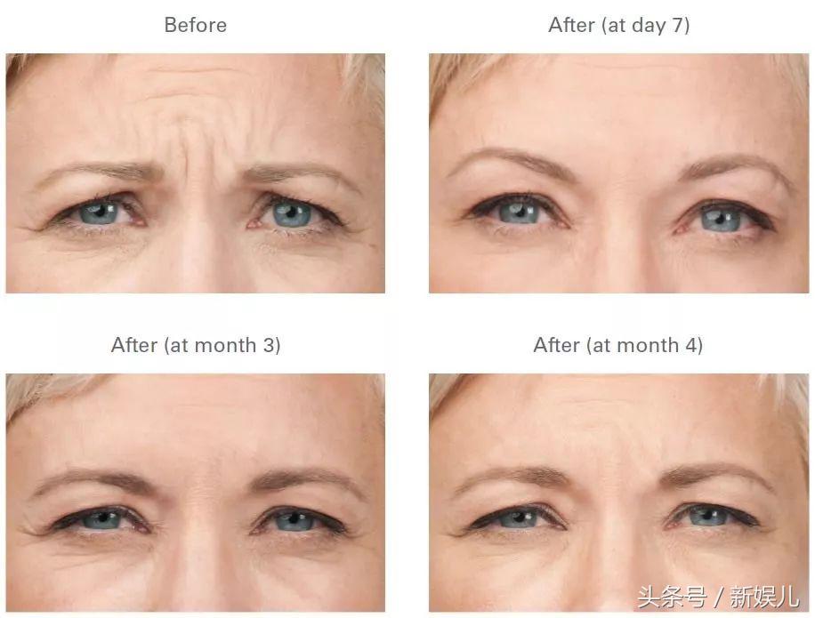 为什么范冰冰比林允气质好,范冰冰王菲谁漂亮