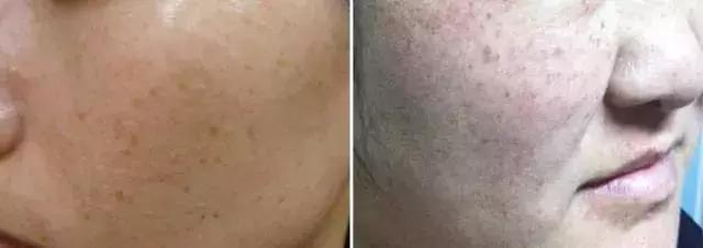 谁说美白要花天价？100块从此告别非洲肌！