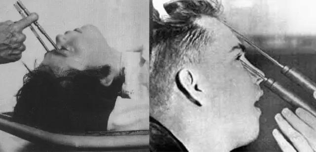 百年残暴治疗史堆砌的事实:同性恋不是病,请放弃治疗