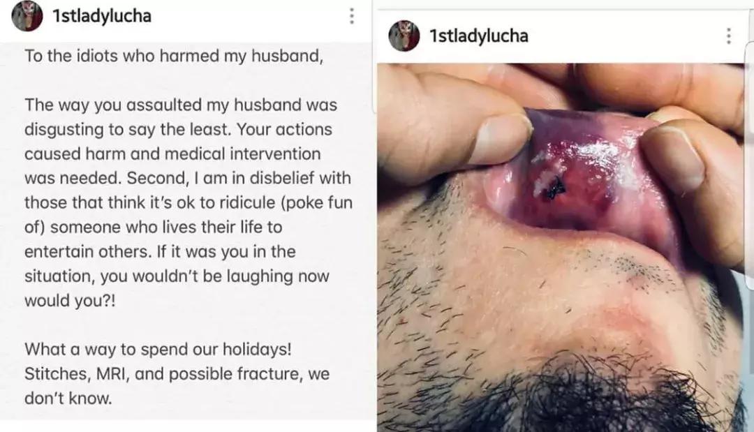 早期wwe最残忍的十场比赛,wwe意外受伤视频集锦