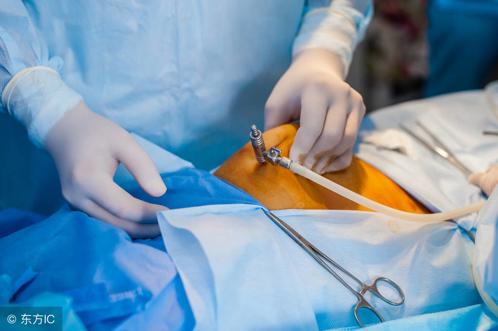 清远医疗纠纷律师咨询收费,清远医疗纠纷专业律师