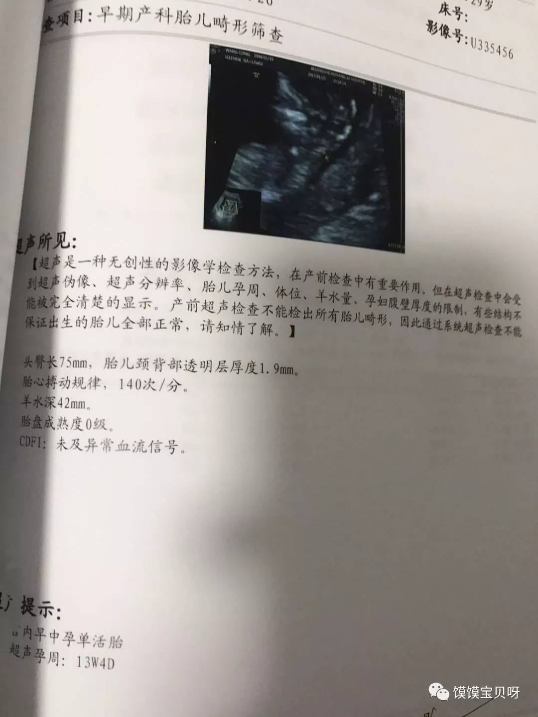 绮変笣绾︾,瀛曞绮変笣鎶曠