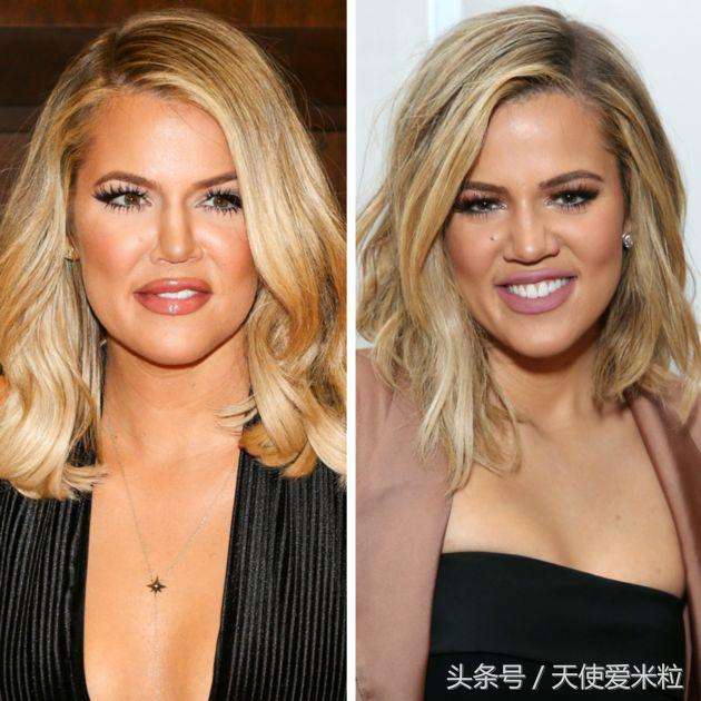 最新的整形塑形手术,7种整形手术可以尝试