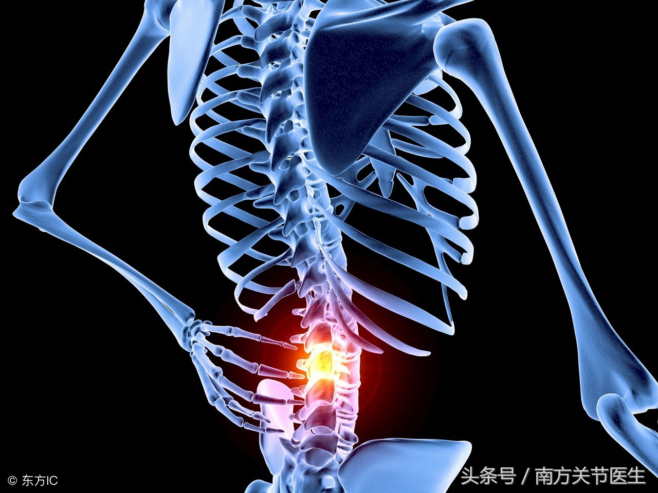 腰间盘突出压迫神经引起腿疼咋治,腰间盘突出会压迫神经腿疼怎么办