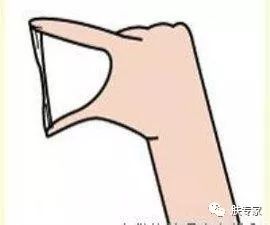 白带异常应该怎么办呢,白带异常怎么都治不好怎么办