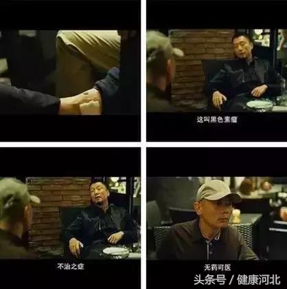 手背后期形成的痣怎么处理,痣的表皮抠掉了会长出突出的痣吗