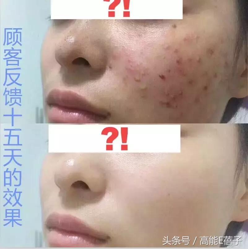 蔡徐坤angelababy2018,蔡徐坤用什么护肤