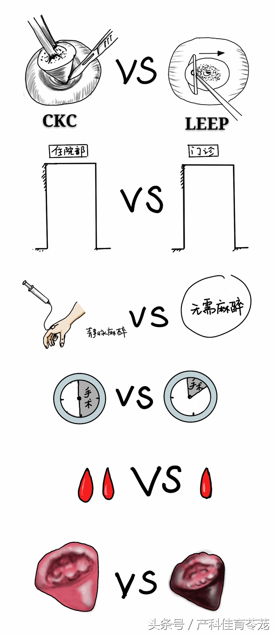 宫颈锥切术是怎样的过程,宫颈锥切手术后病理结果几种