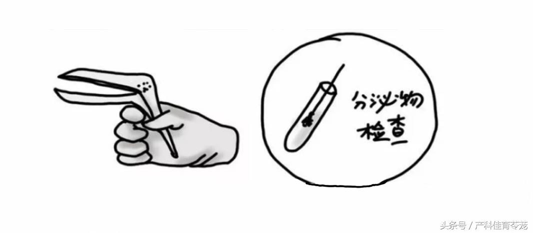 做完宫颈锥切多长时间能洗澡,做宫颈锥切是全麻还是半麻好