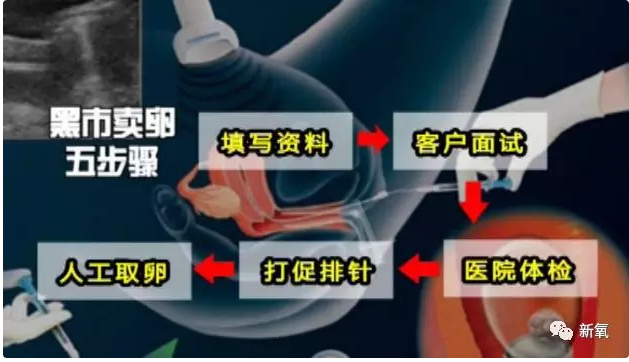 那些为了钱卖自己卵子的女生后来都怎样了？