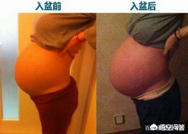 什么是浅入盆和完全入盆,浅入盆代表胎位正吗