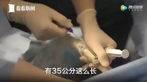 女大学生捐卵案完整,女大学生捐29个卵