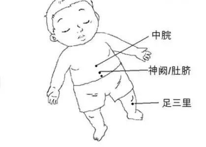 小儿腹泻艾灸治疗方法,艾灸小儿腹泻穴位
