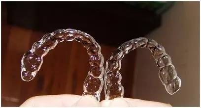 隐形牙套免费试戴珠海,福建免费隐形牙套