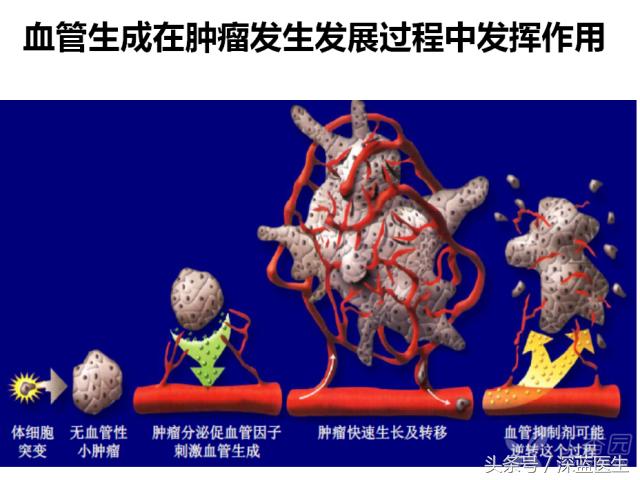 治疗肺癌的靶向药共几种,肺癌治疗方案一线和三线什么区别