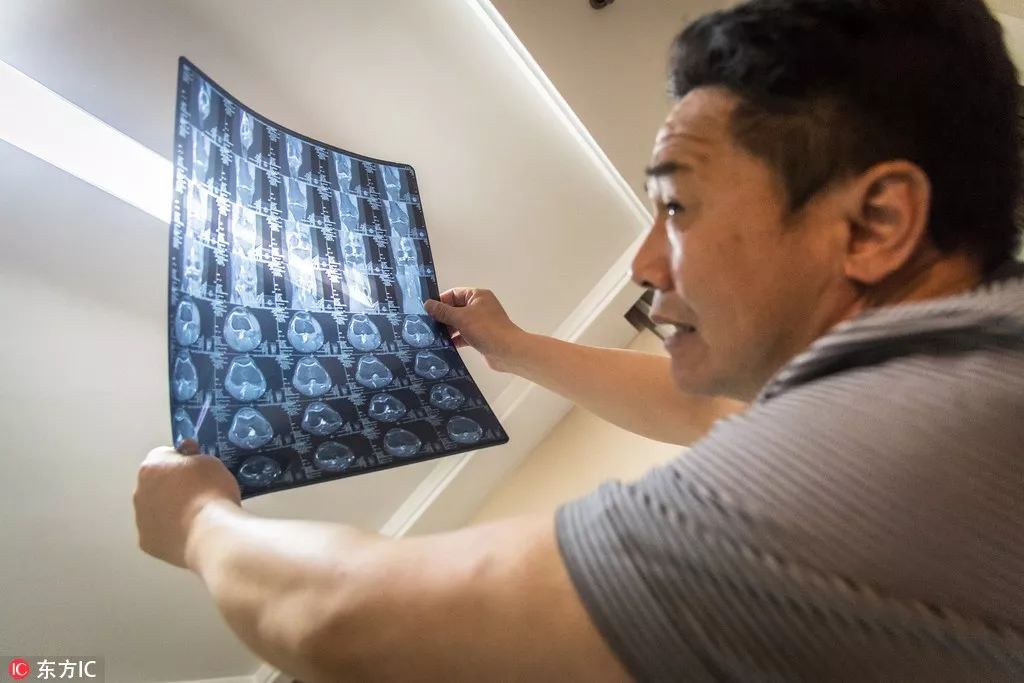 超·广角｜足坛神医严诚——细“针”密缕匠人精神