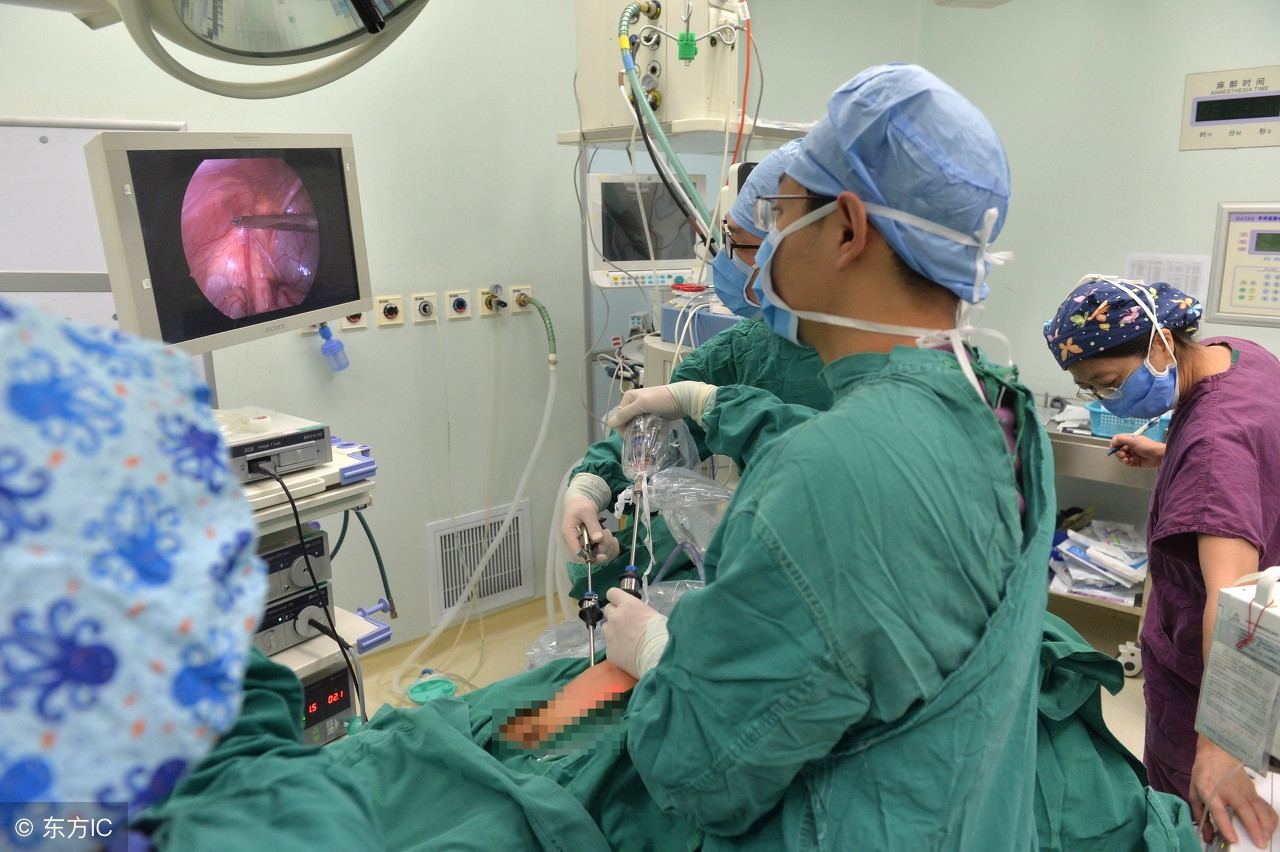 夫妻之间避孕上环好还是吃药好,避孕男的上环好还是女的上环好