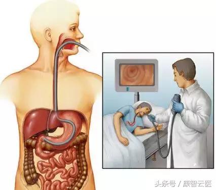 做胃镜怎样配合医生才不感觉痛苦,做普通胃镜怎么配合能舒服点
