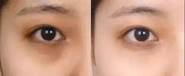 lamer去黑眼圈,lamer浓缩眼霜去黑眼圈