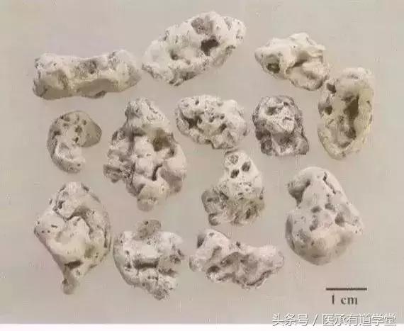 每天最少学一味中药赤小豆,每天最少学一味中药丝瓜络