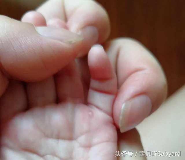 宝宝突然厌食还爱哭,宝宝突然厌食最快的解决方法