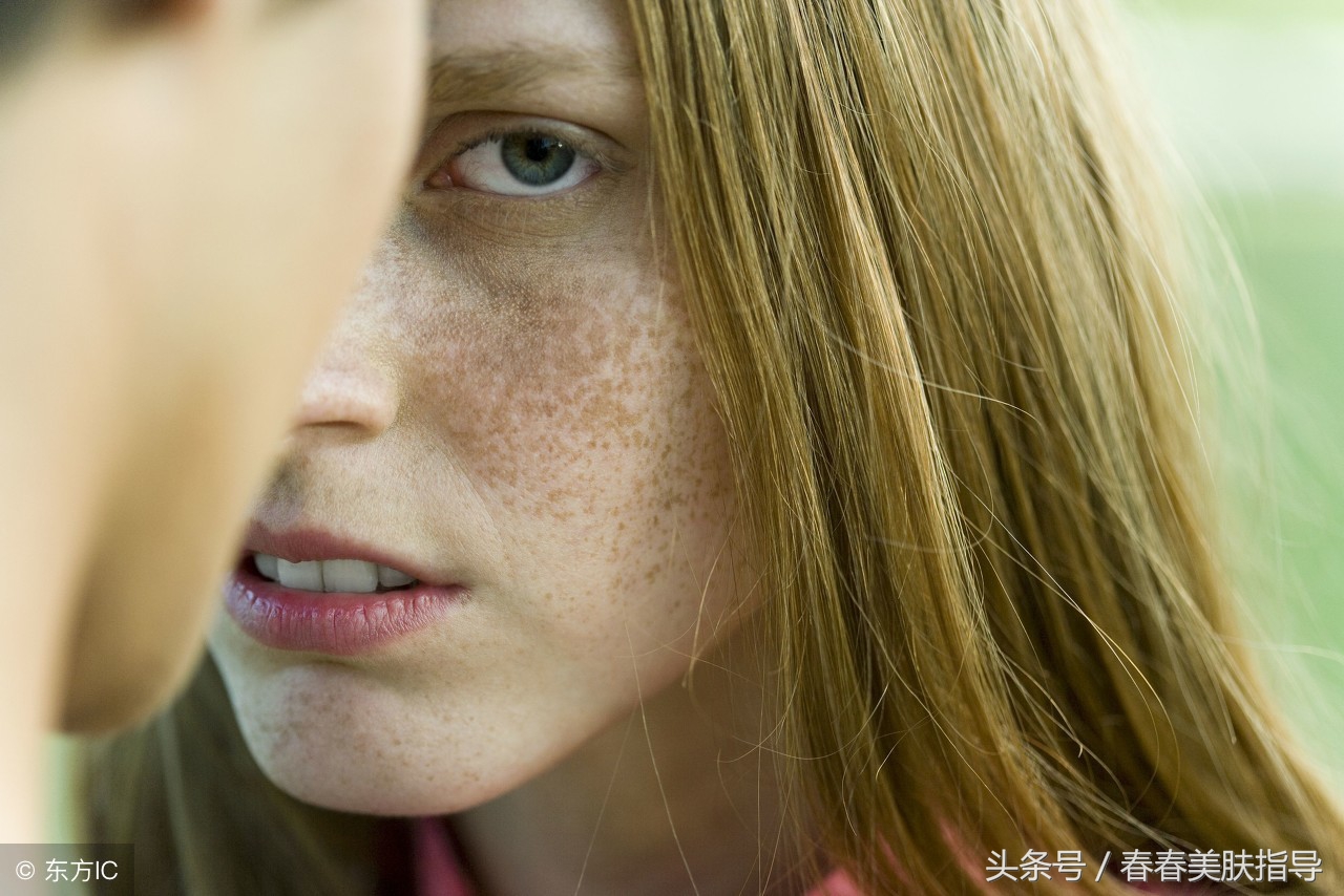 怎样去除脸上的黑色素斑点,如何去除脸上黑斑和色素沉着