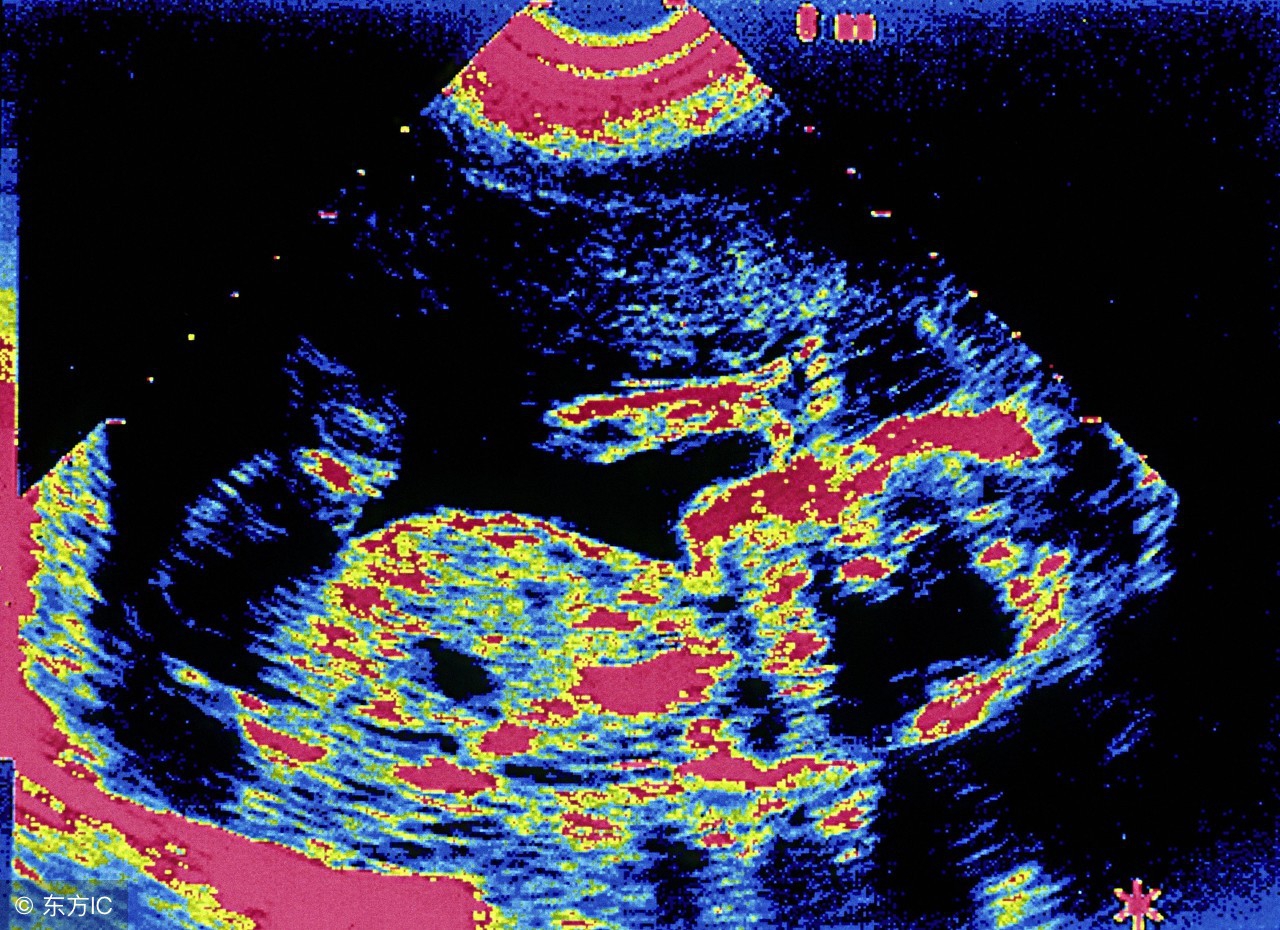 小产怎么才算恢复得好,小产后的注意事项有哪些