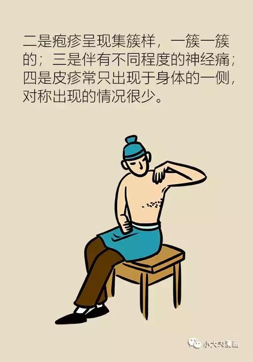 协和医院可以打带状疱疹疫苗吗,协和医院带状疱疹专家