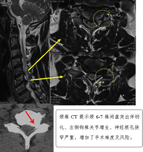 空军总医院骨科怎么样,北京军区总医院骨科治颈椎病