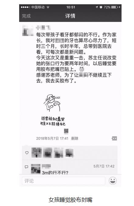 小女孩睡觉张嘴贴胶布,女孩睡觉嘴巴贴胶布