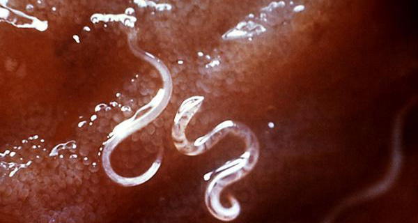 吃生鱼片如何避免寄生虫,生鱼片里面的寄生虫能煮死吗