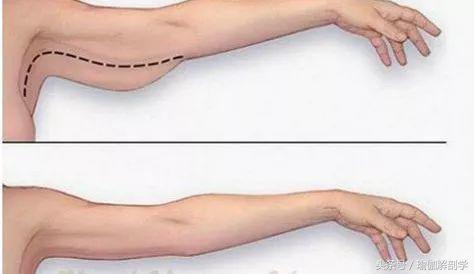 夏天瘦手臂有绝招,夏天怎么瘦最简单