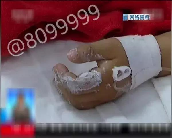 涂改液爆炸,如何辨别涂改液爆炸